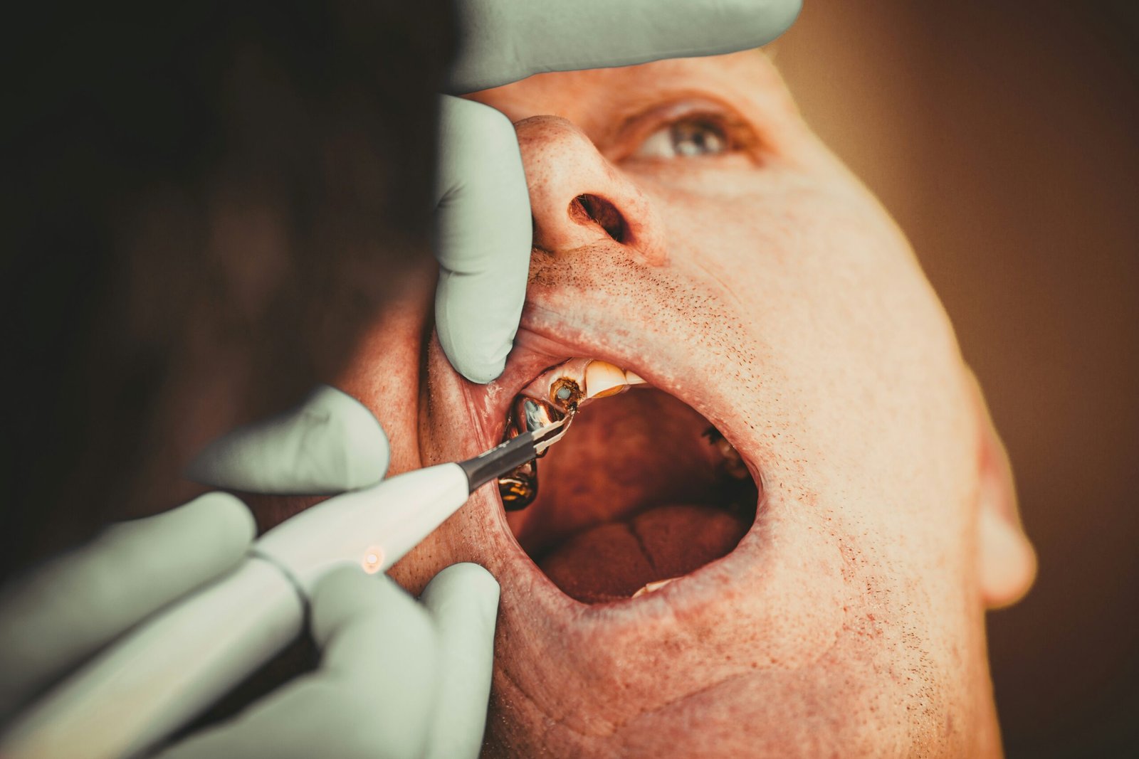 Dental professional performing a treatment in a clinical dental setting